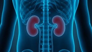 Early Treatment Linked to Lower Risk of Kidney Failure in Cancer Complication, BMJ Study Finds